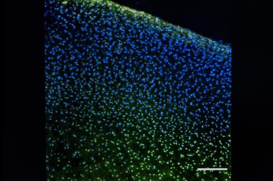 Broskvävnad med gröna nanopartiklar och blåa signaler från kondrocyter.