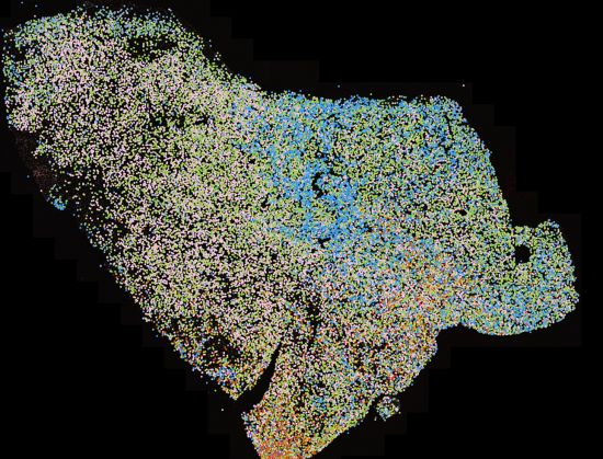 Genom visualisering skapas kartor över vävnadssnitt från ett dussintal tumörer för att se hur cellerna som identifierats i studien är organiserad i tumörvävnaden. Här en cellkarta över ett 2x1,5 mm stort tumörsnitt.