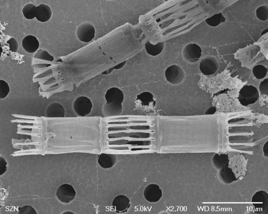 Mikroskopisk bild Skeletonema