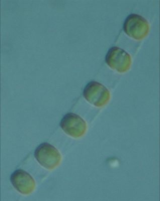 Mikroskopisk bild Skeletonema